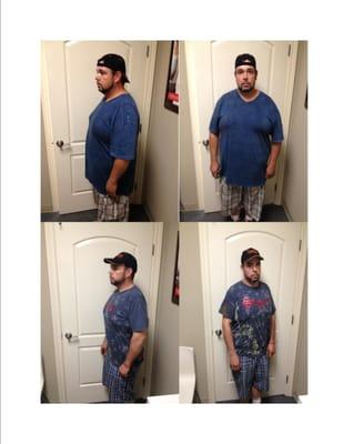 Heracio Lost 79lbs!