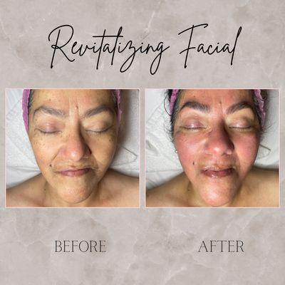 Revitalizing facial-circulated blood