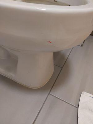 Blood on toilet