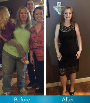 Patient of the Week: Tammy Dirks  "I no longer have any health related issues! Thank you for my second chance at life!"