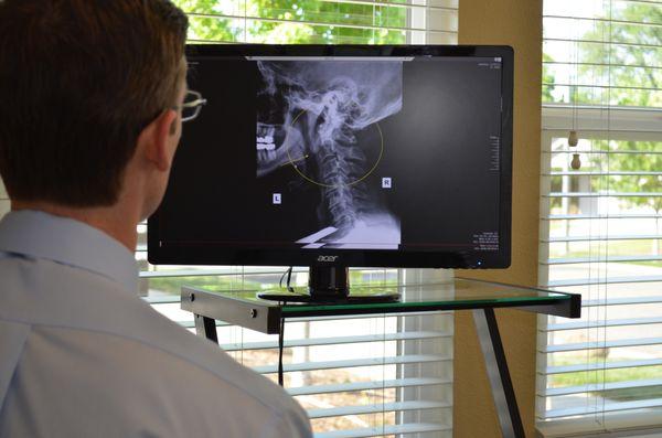 Reviewing patient xray prior to adjustment.