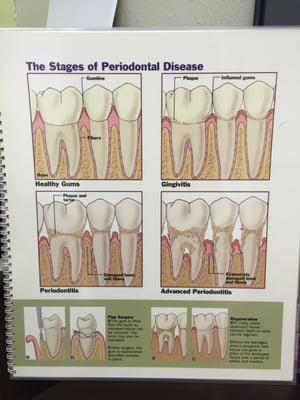 Periodontal Awareness