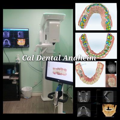 We offer full thorough dental exam packages including dental cleanings.
Please Call 
Cal Dental Anaheim
(714) 828 0508