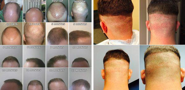 Hair Loss Center