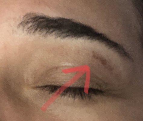 The scar under my eyebrow