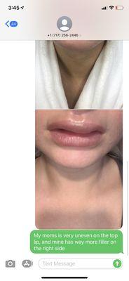 Photos of my horrendous lips and the last text sent before never again hearing a response.