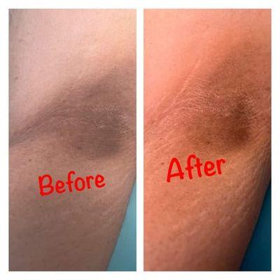 Luxury Under Arm lightning wax