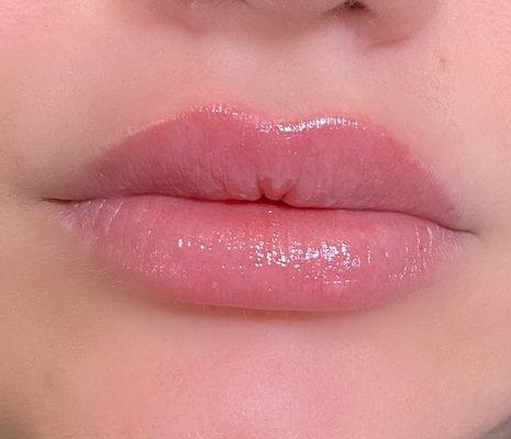 Lip filler, no needle, healed lip blush