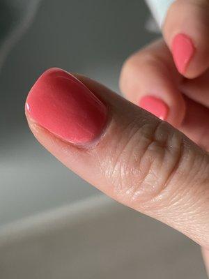 Inflamed cuticles from being cut badly