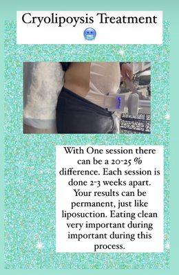 Cryolipoysis treatment