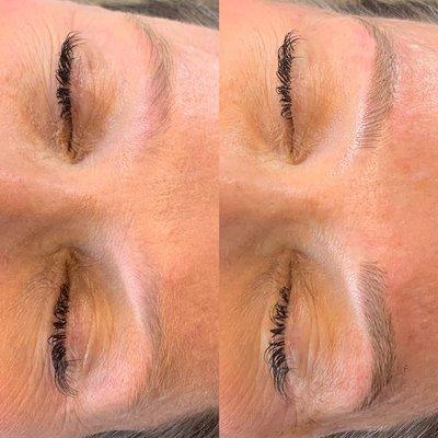 Before & After Microblading