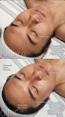 Revitalize Facial