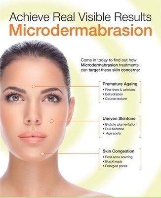 Microdermabrasion