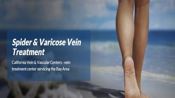 California Vein and Vascular Center