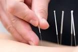 Dr. Walters offers Acupuncture!