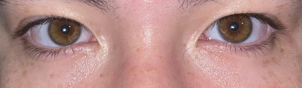 Lash Lift