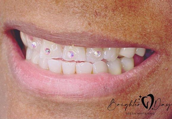 Tooth gems are trending! No drilling! Semi permanent, can last up to 8 months.