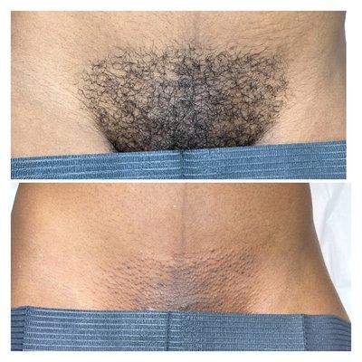 Brazilian Wax