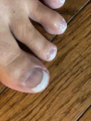 Messy paint, poor cuticle grooming and took a chunk out of my toe