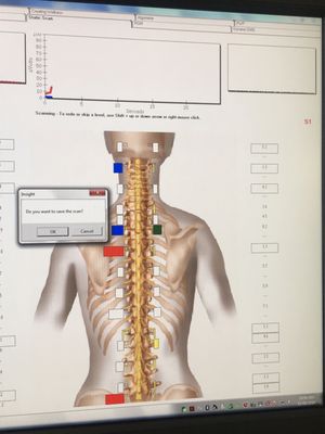 My sublaxation is gone!I used to have all black (very severe), red (severe) and yellow (moderate) 3 years ago when she did my xray.