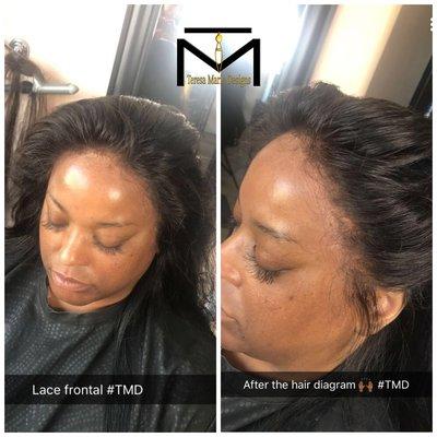 Customized Lace Frontal using bold hold and another protective sew in