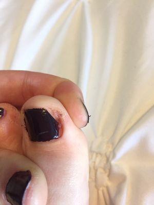 She ripped the skin off on the side of my toe! Left me bleeding and in pain. Not to mention the TERRIBLE paint job