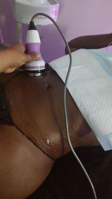 Lipo Cavitation service for stubborn fat areas.