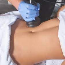 Cavitation for fat reduction.