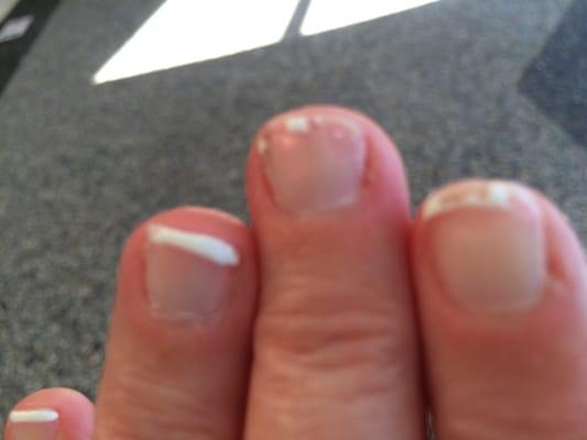 Two days after manicure at Rosie Nails in Oneida, NY