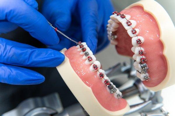 Practice Makes Perfect  |  Dental Assisting student practices banding and de-banding traditional metal braces on a typodont