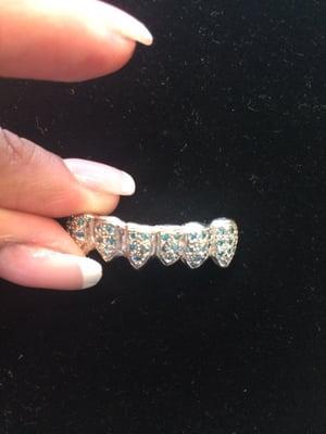 Custom fit 18k white gold grills with hand-set diamonds