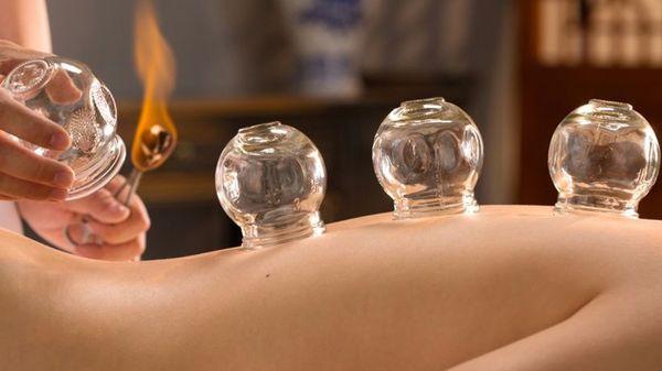 Cupping