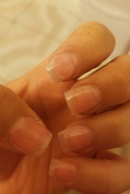 Shity nails over all . Horrible cuticles!