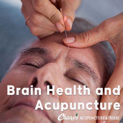 Acupuncture stands as a natural therapeutic option accessible to a broad spectrum of individuals, providing a pathway to enhanced health.