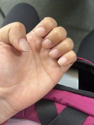 My nails after she took the gel off