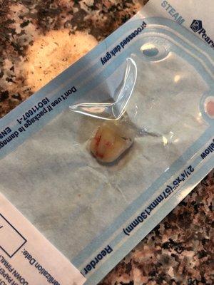 my wisdom tooth that needed to be extracted