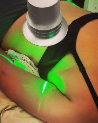 Green Laser Burn that fat off!