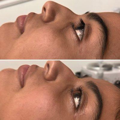 Lash lift