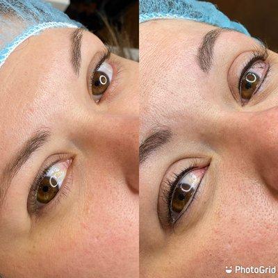 Top and Bottom lash line enhancement.