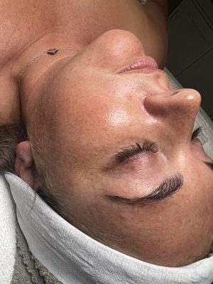 Eyebrow wax and derma plane facial