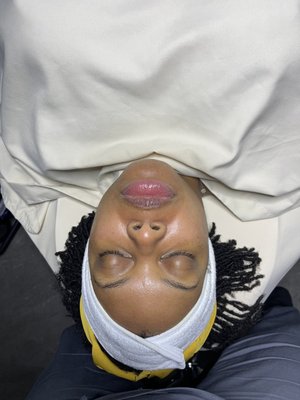 After photo: Brightening facial with added hydration treatment.