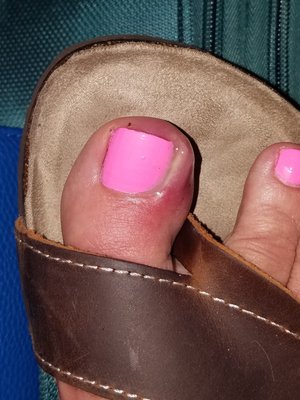 My mom went to WOW for a pedicure and specifically told the woman not to cut her cuticles.  Her toe looked like this next day. Never again.