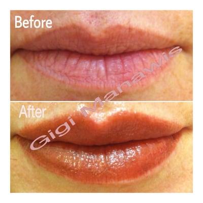 Lips before and after