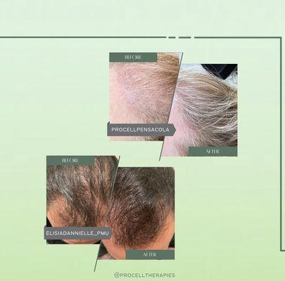 As we age, the growth (or "anagen") phase of the hair cycle gets shorter and shorter, resulting in hair loss and thinning.