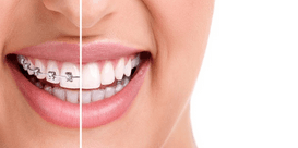 Orthodontists in Garland Texas