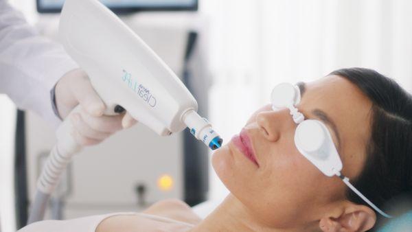 Alma ClearLift is a no- downtime, painless, laser toning procedure to tighten and brighten your skin!