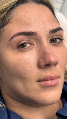 Microblading technique