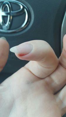 Here is the cut on my finger once i had left and it stopped bleeding.