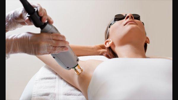 Laser hair removal with syneron-candela.com