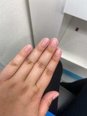 terrible nails